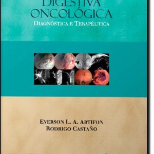 Endoscopia Digestiva Oncológica