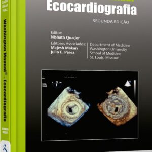 Washington Manual Ecocardiografia
