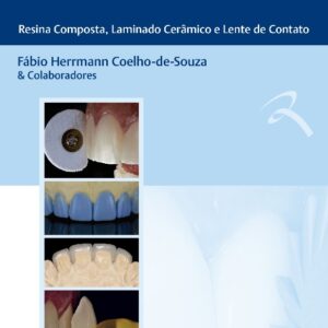 Facetas Estéticas – Resina Composta, Laminado Cerâmico e Lente de Contato.
