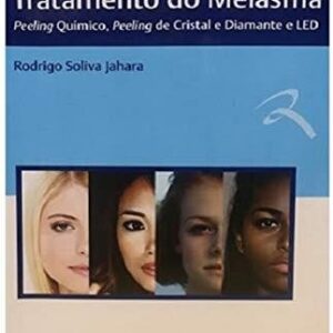Sistema 4m no Tratamento do Melasma