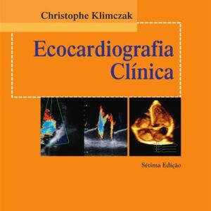 Ecocardiografia Clínica