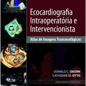 Ecocardiografia Intraoperatória e Intervencionista