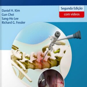 Cirurgia Endoscópica da Coluna Vertebral
