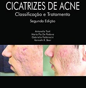 Cicatrizes de Acne