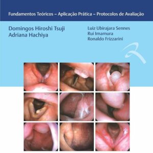 Forl Videonasolaringoscopia