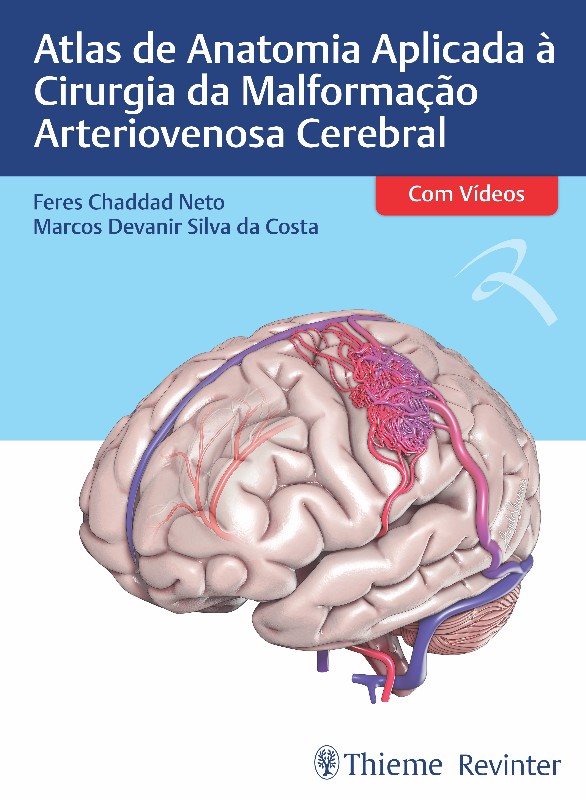 Atlas de Anatomia Aplicada à Cirurgia da Malformação Arteriovenosa Cerebral