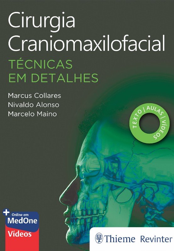 Cirurgia Craniomaxilofacial: Técnicas em Detalhes