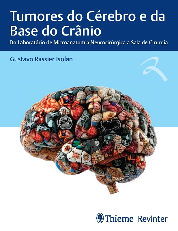 Tumores do Cérebro e da Base do Crânio